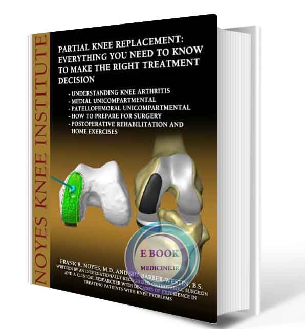 دانلود کتاب Partial Knee Replacement: Everything You Need to Know to Make the Right Treatment Decision  (ORIGINAL PDF)